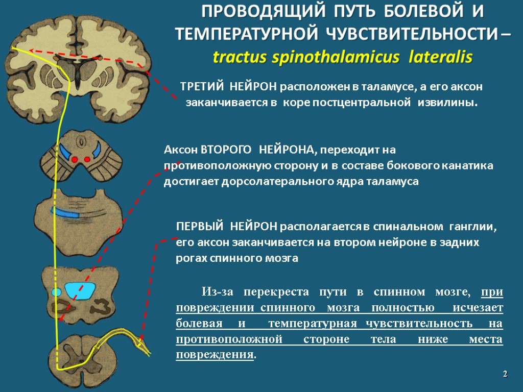 ПРОВОДЯЩИЙ ПУТЬ БОЛЕВОЙ И ТЕМПЕРАТУРНОЙ ЧУВСТВИТЕЛЬНОСТИ – tractus spinothalamicus lateralis 2 ТРЕТИЙ НЕЙРОН расположен